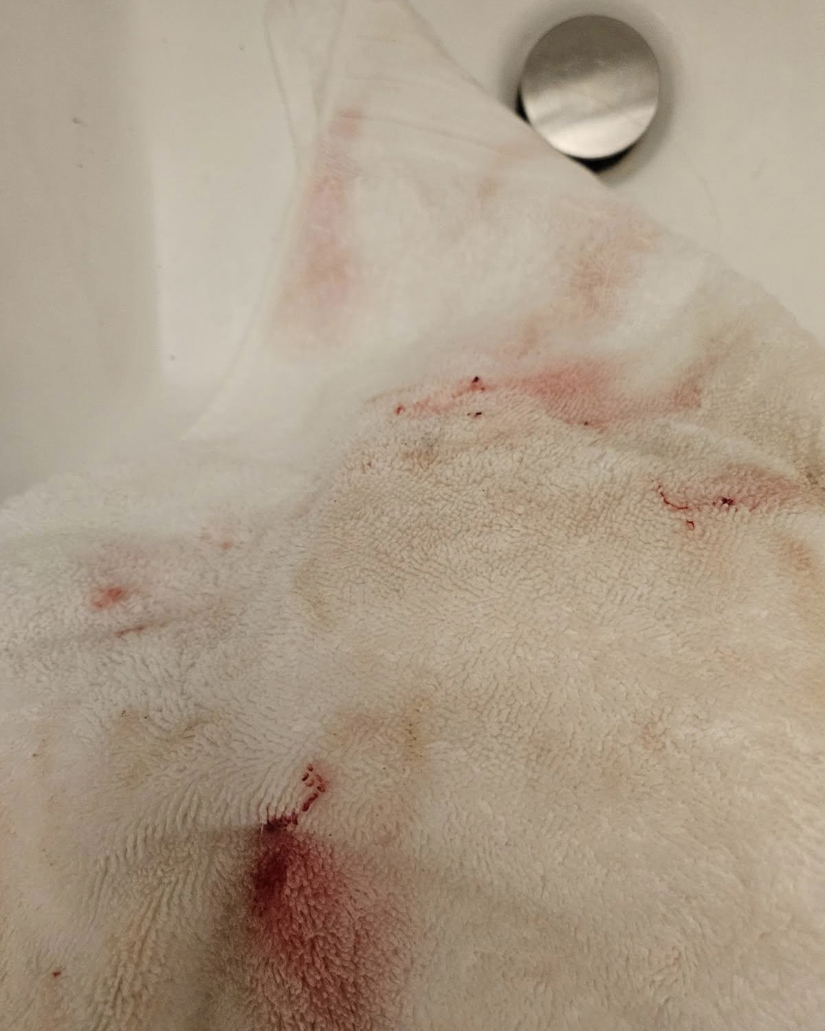 Bloody towel in the hotel room
